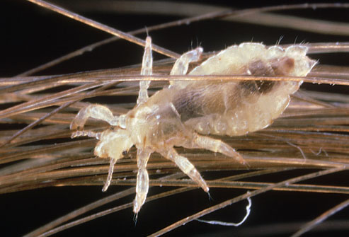 A close up of a head lice