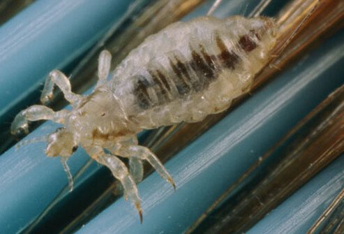 Head lice are parasites that can cause itching.